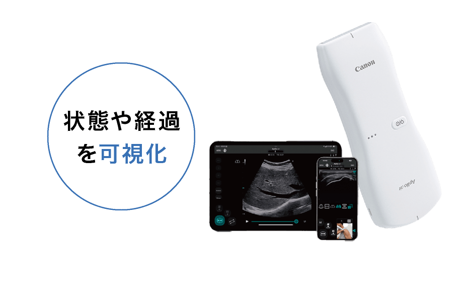 超音波画像観察装置 Aplio air